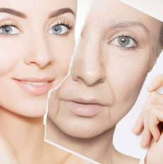 Facial Signs of Aging